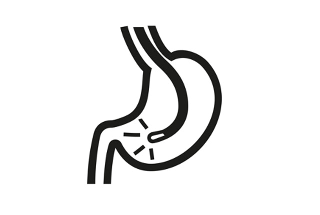 胃カメライラスト