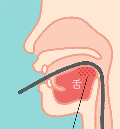 口から挿入する内視鏡検査イラスト