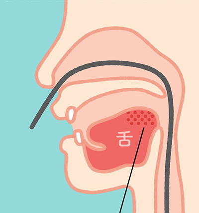 経鼻内視鏡検査イラスト