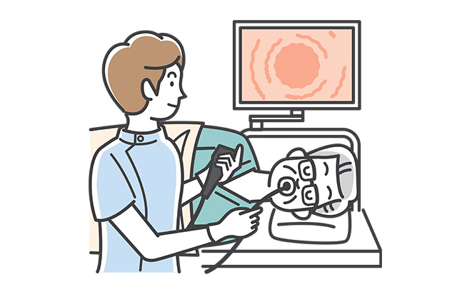 胃カメラ検査イラスト