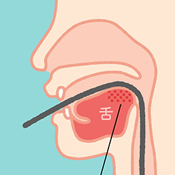 口から挿入する内視鏡検査イラスト