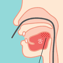 経鼻内視鏡検査イラスト